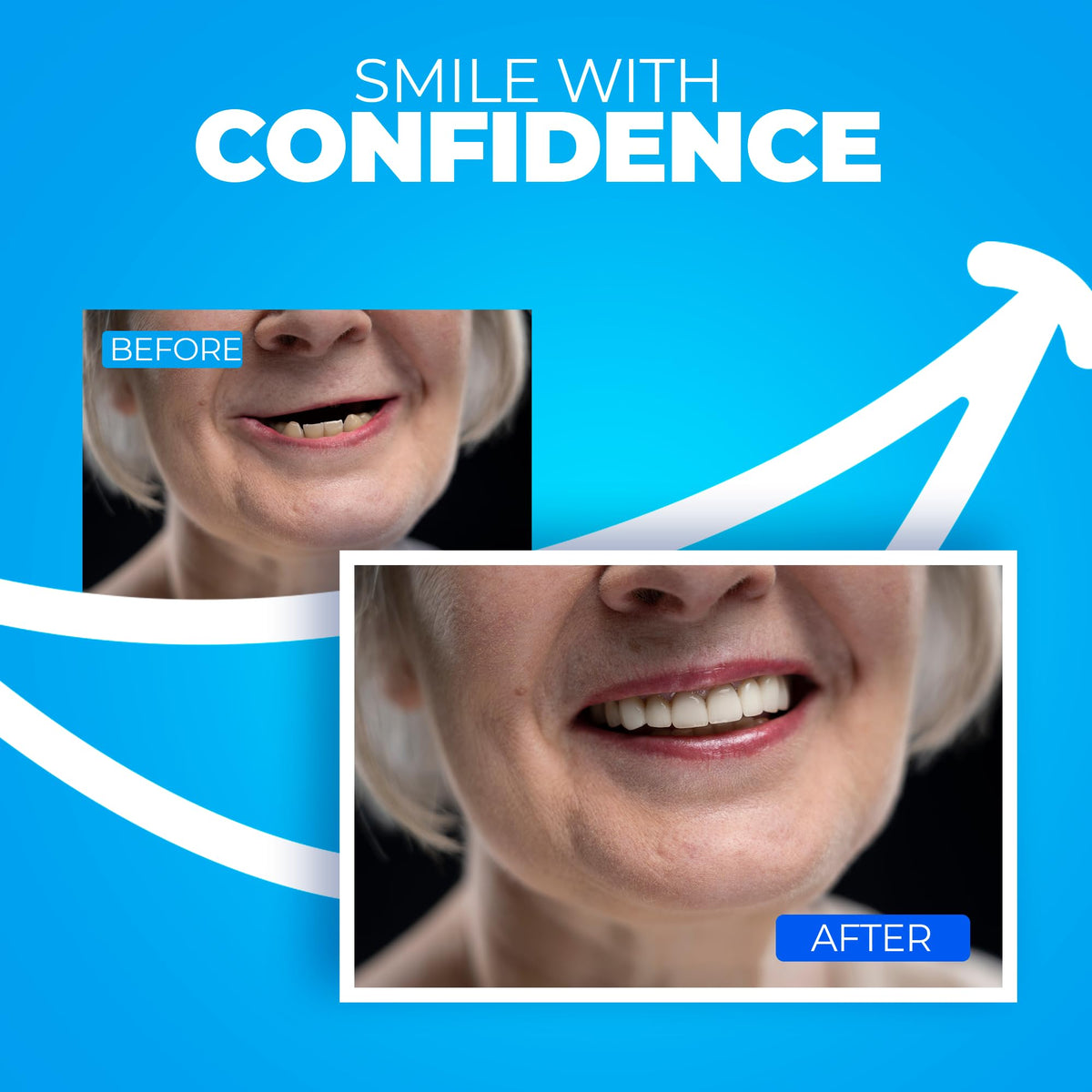 Customizable Dentures Kit with 12 Pieces D214